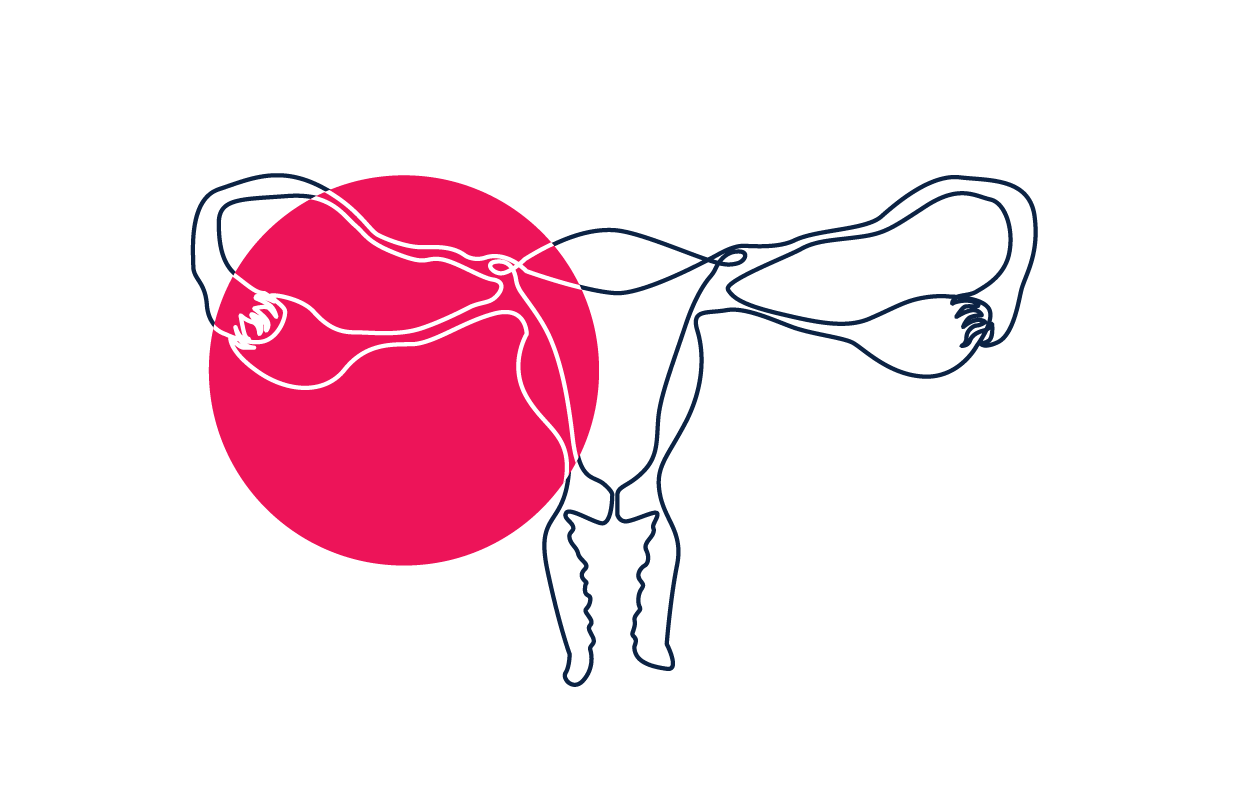 Course Image Implants and IUDs: Comparing and Inserting Long Acting Reversible Contraceptives (LARC) May 2026